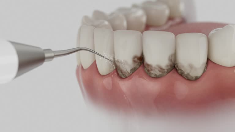 Trusted Dental Crowns And Bridges service in Carlisle, AR - Dentist Open Now